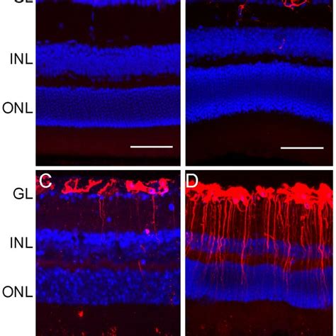 Retinal Pigment Epithelium Rpe Damage Photoreceptor Degeneration And