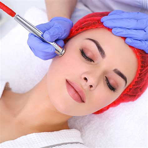 Professional Treatment For Acne Scars In Dubai