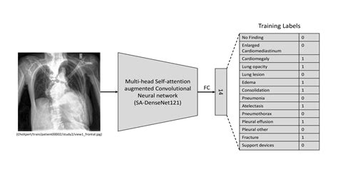 Computer Aided Diagnosis Of Thoracic Diseases In Chest X Rays Using