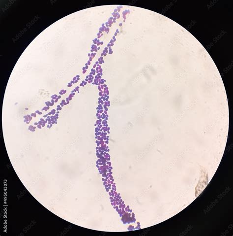 Candida Spp Fungi Emerging Multidrug Fungus Candida Albicans C