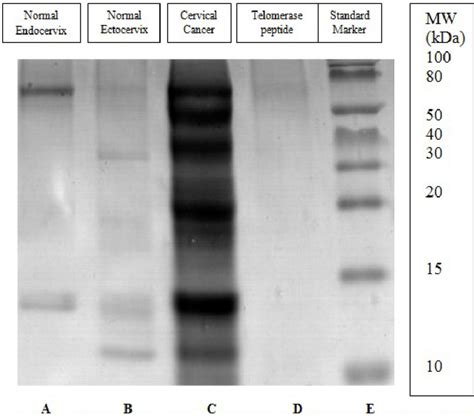 Protein profiling and characterization of cervical cancer biopsy tissue... | Download Scientific ...