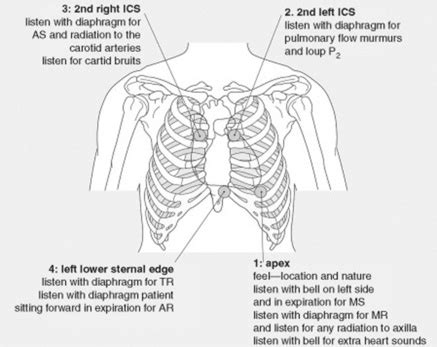 Heart Murmur Diagram