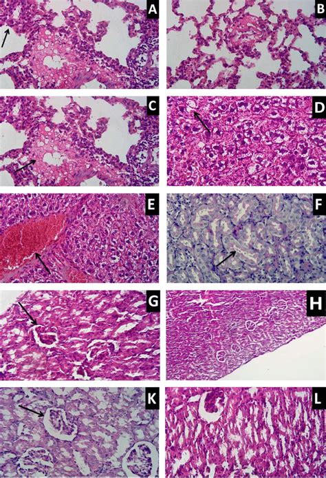 The Histopathological Changes Of Liver Kidney And Lung A Serous