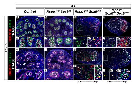 Lack Of Testis Cords In Xy Rspo1 Ko Sox8 Ko Sox9 Cko Triple Mutant