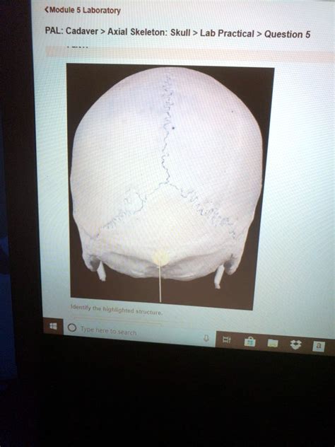 Solved Module Laboratory Pal Cadaver Axial Skeleton Skull Lab