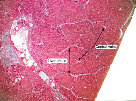 liver anatomy labeled