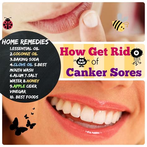 #10 Home Remedies for Canker Sores: Happy Lips