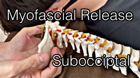 How To Do Myofascial Release For Suboccipital Muscles English Youtube