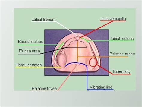 Anatomical Landmarks Of The Maxilla And Maxillary Arch Ppt Download