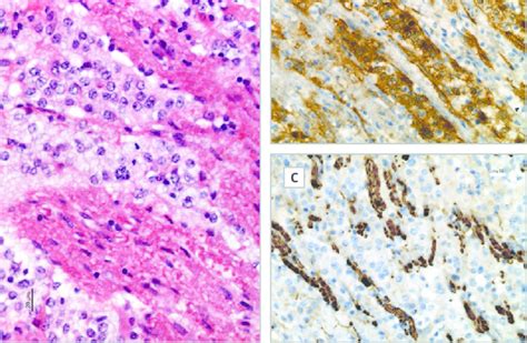 Histochemical And Immunohistochemical Features A B Download