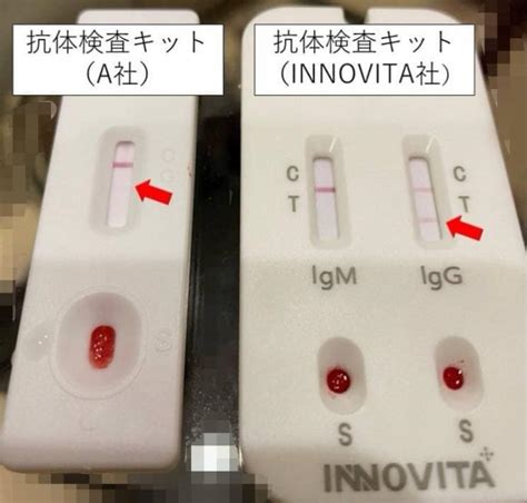 新型コロナウイルス（2019 Ncov）抗体検査キット（金コロイド法）再入荷のお知らせ ブリジアン株式会社のプレスリリース