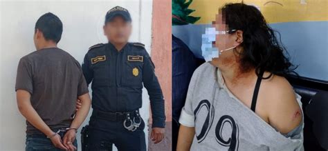 Capturan A Acusado De Agresi N Con Machete A Su Conviviente En Santo