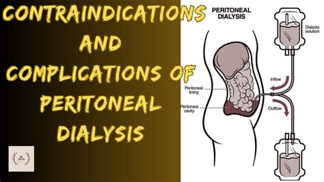 Contraindications Of Peritoneal Dialysis Infectious And Non Infectious