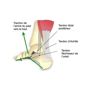 Pied Plat Valgus Dr Bovier Lapierre