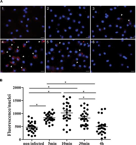 Frontiers Cd Sema D Increases Macrophage Infection By Leishmania