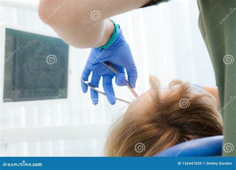 Dentist Removes Tooth Stock Image Image Of Illness 126447039