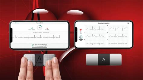 What are the differences between Kardia Mobile 6L and Kardia Mobile ...