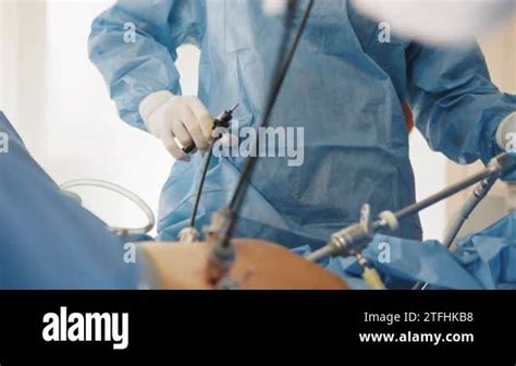 Operation Using Laparoscopic Equipment The Surgeons Doing Laparoscopic