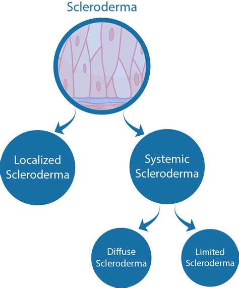 What Is Scleroderma Sclerodermaindia