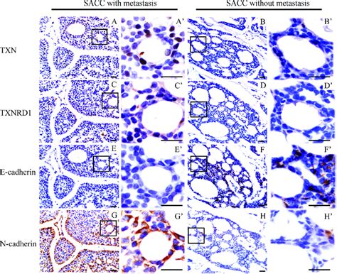 Immunohistochemical Staining Reveals Differential Expressions Of Download Scientific Diagram