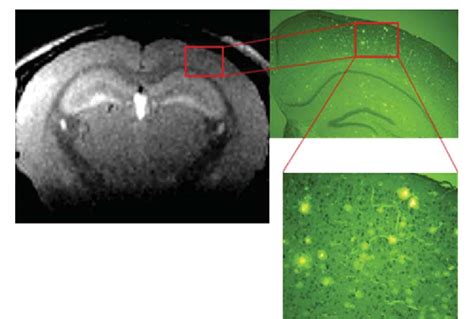 Figure 1 From Magnetic Resonance Imaging Of Amyloid Plaques Using