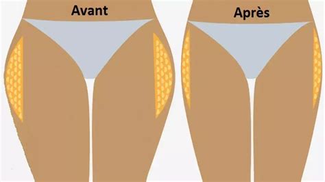 Exercices Pour Dessiner Les Hanches Et R Duire Le Tour De Taille E Savoir