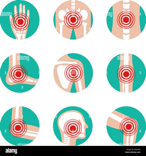 Vector Set Of Human Joints With Pain Rings Disease In Bone Knee Leg