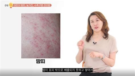 소아 피부 물집 수포 우리 아이 여름철 피부관리tip Ft 땀띠 농가진 수족구 이소한의원