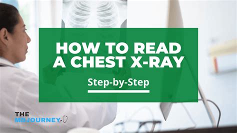 How To Read A Chest X Ray Step By Step Themdjourney