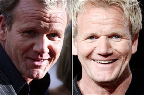 Gordon Ramsay Plastic Surgery Before and After Botox and Facelift ...