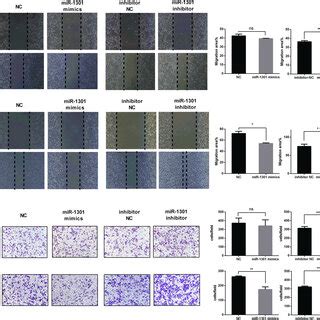 Inhibition Of Mir Promotes Crc Cell Migration And Invasion Ab