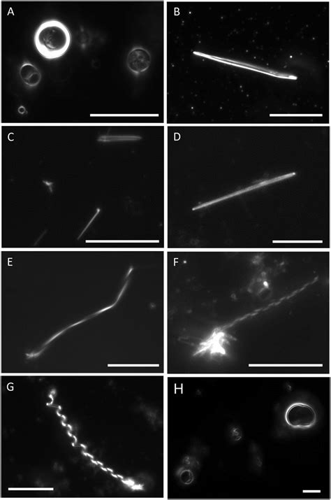 Darkfield Optical Micrographs Of Aqueous Dispersions Of Various