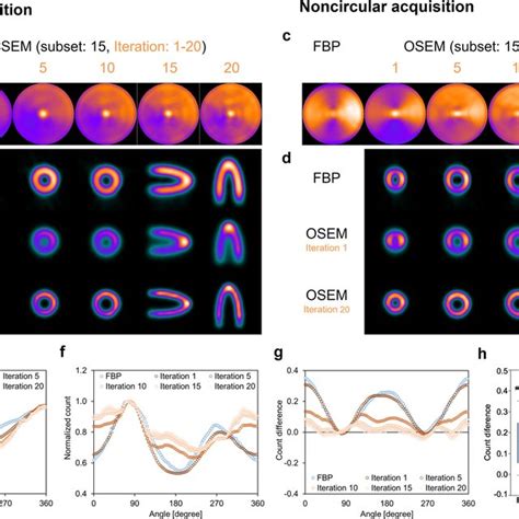 The Anthropomorphic Torso Phantom Images And Its Count Distributions Download Scientific