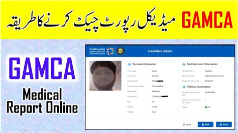 How To Check Gamca Medical Report Online Get Gamca Medical Result