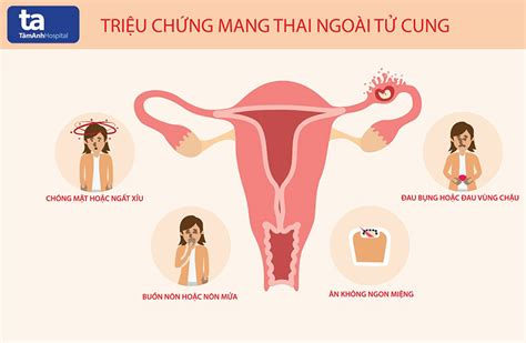 Dấu Hiệu Mang Thai Ngoài Tử Cung Sớm Nhất Mẹ Bầu Cần Thận Trọng ...