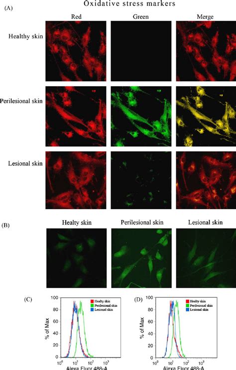 Oxidative Stress Markers A Representative Confocal Microscope Images