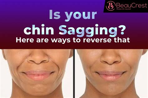 3 Ways To Firm Saggy Face Skin Justinboey