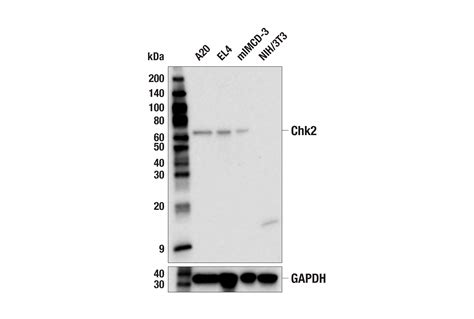 Chk2 E7L7J Rabbit MAb Cell Signaling Technology