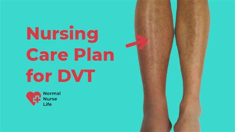 Nursing Care Plan For Venous Insufficiency