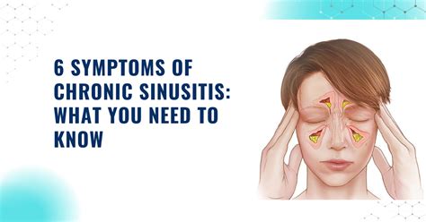 6 Symptoms Of Chronic Sinusitis What You Need To Know By Dr Muaaz