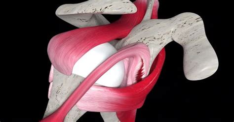 Shoulder Labral Tear Repair Stock Video Envato Elements