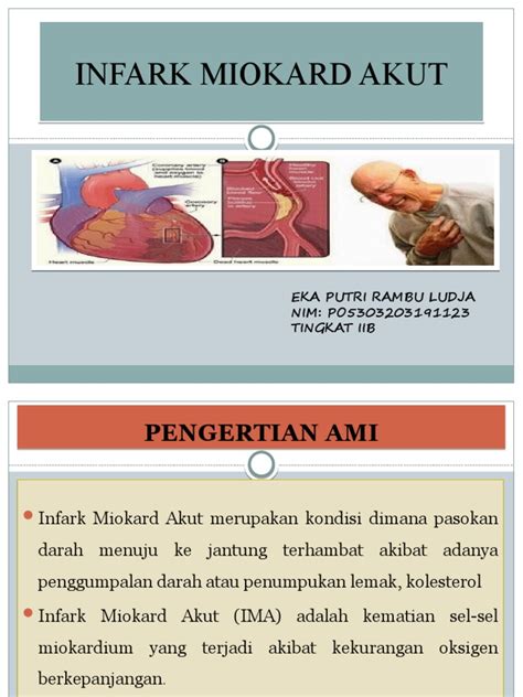 Infark Miokard Akut Pdf