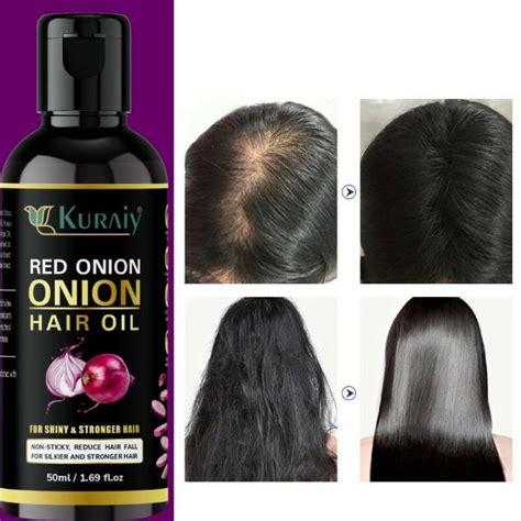 Kuraiy Pure Onion And Basil Oil For Anti Hair Fall Pack Of Hair Oil