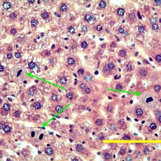 Histology of mouse liver after acetaminophen injection. Animals were ...