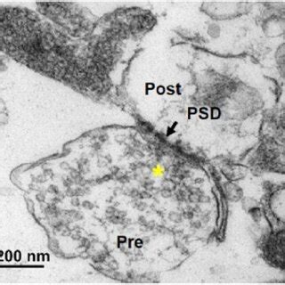 Representative Transmission Electron Micrographs Of Synaptosome