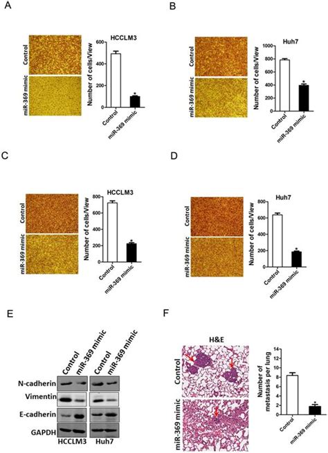 Mir 369 Inhibits Liver Cancer Progression By Targeting Zeb1 Pathway And