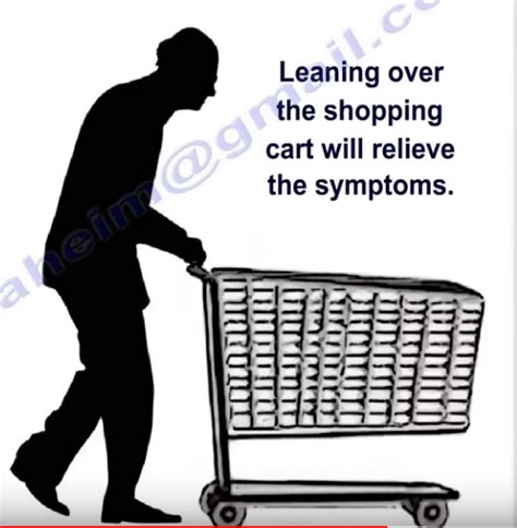 Dr Nabil Ebraheims Blogspot Lumbar Spinal Stenosis