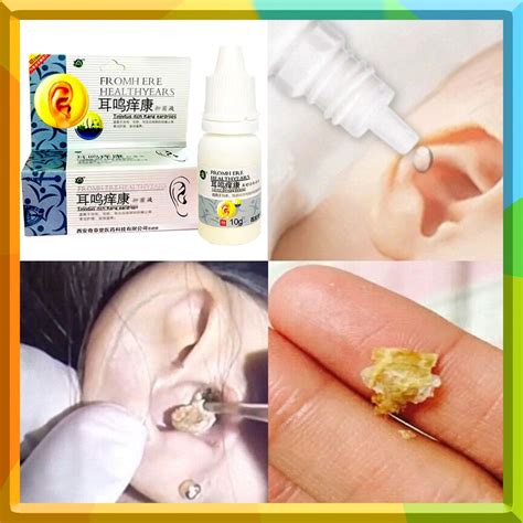 Ear Drops Cleaner Ear Wax Remover Liquid For Acute And Chronic Otitis