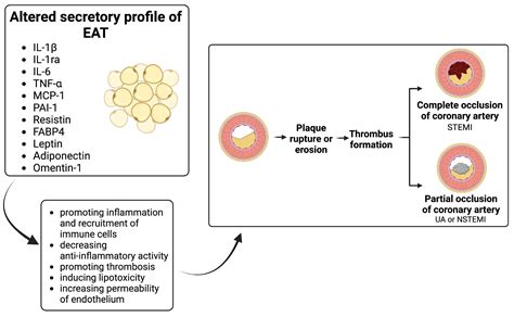 Ijms Free Full Text The Role Of Epicardial Adipose Tissue In Acute