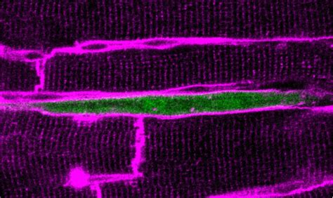 Normal Vs Mutant Cardiomyocyt IMAGE EurekAlert Science News Releases